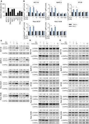 A metabolic shift toward glycolysis enables cancer cells to maintain survival upon concomitant glutamine deprivation and <mark class="highlighted">V-ATPase</mark> inhibition